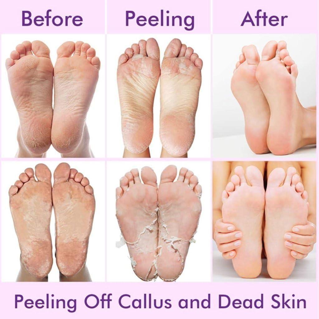 Exfoliating Foot Mask